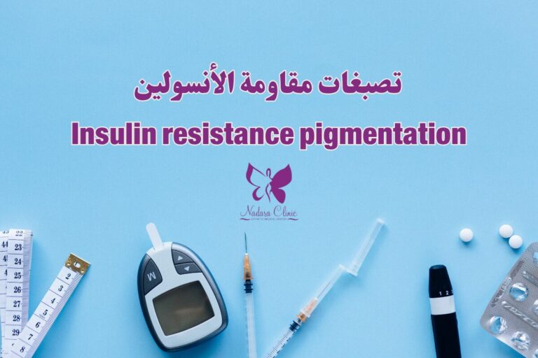 تصبغات مقاومة الأنسولين في الغردقة
